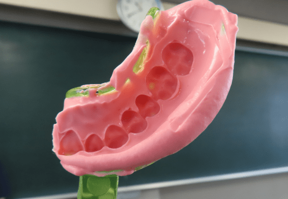 歯のコピー？