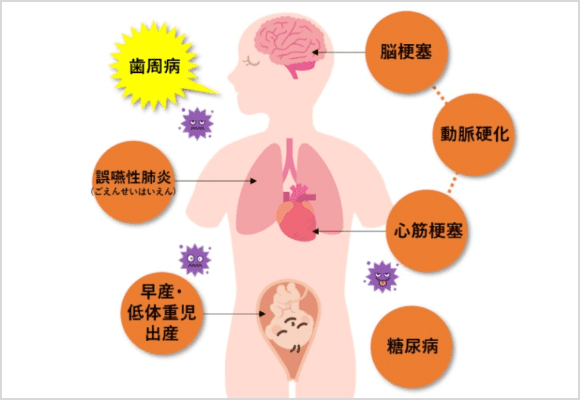 医者が注目する歯周病