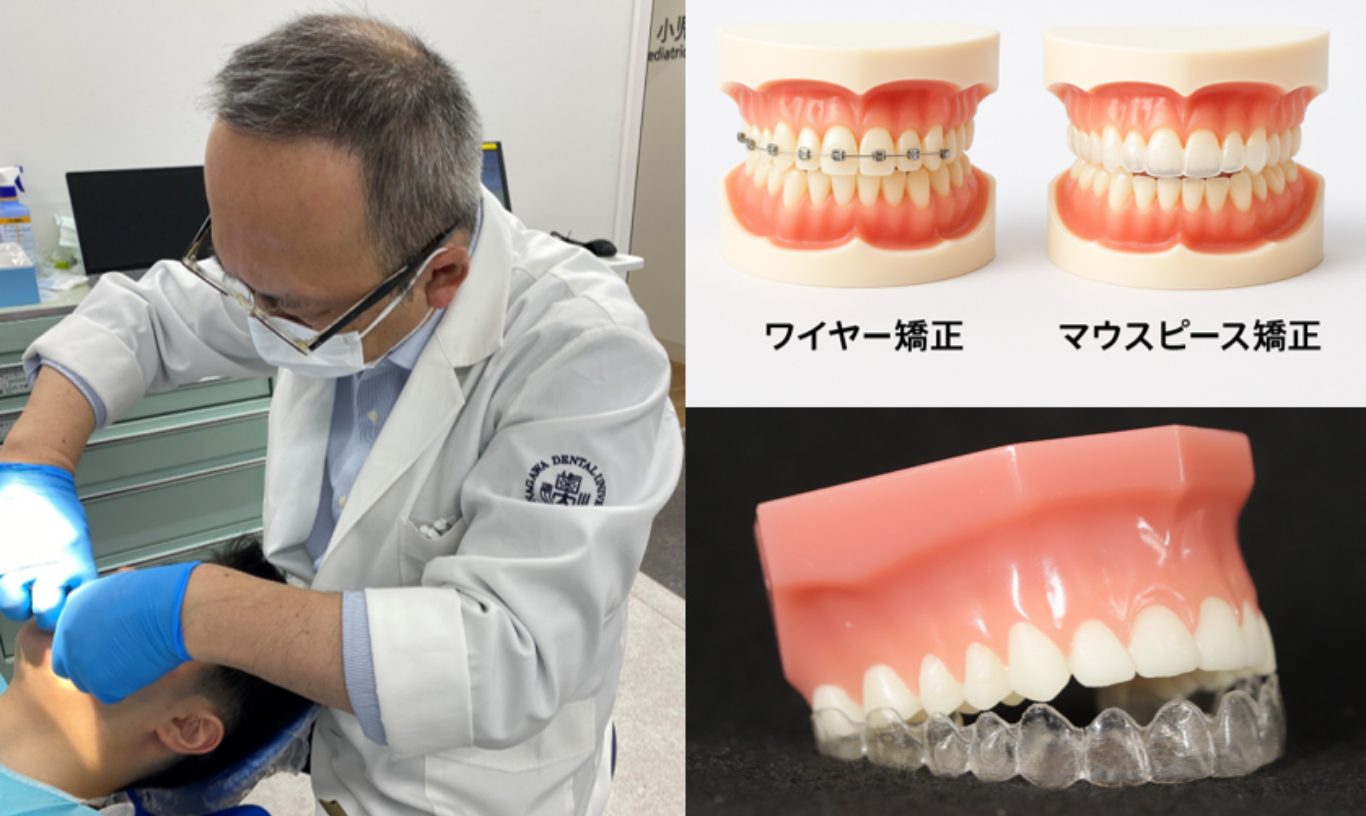矯正装置を調整する様子と、ワイヤー矯正・マウスピース矯正の模型