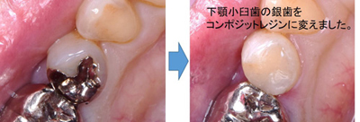 保存・修復診療科 特徴・特色